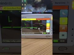 Xem Tại sao Chọn Màn hình LCD theo dõi bệnh nhân Mindray BeneView T1 có nắp trước