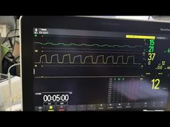 Xem Mô-đun Mindray AG AG và Mô-đun O2 Mô-đun MMS PN 115-023943-00 Demo