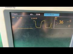 Xem xét kỹ hơn: Bẫy nước Mindray cho 9200-10-10530 Mô-đun khí gây mê trẻ em dành cho người lớn